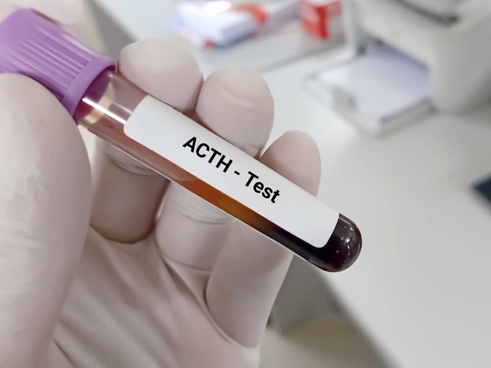 ACTH test