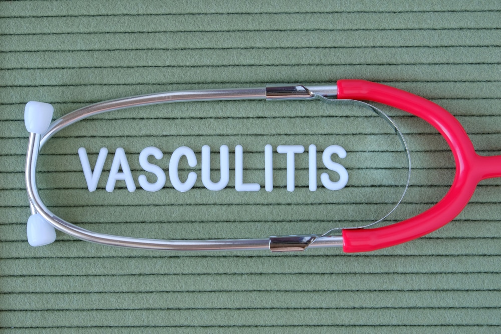 vaskulitis simptomi