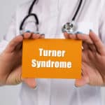 turnerov sindrom