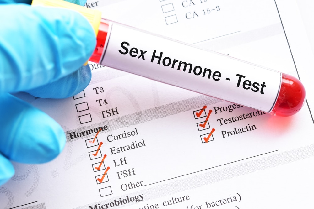 krvni pregledi spolnih hormona