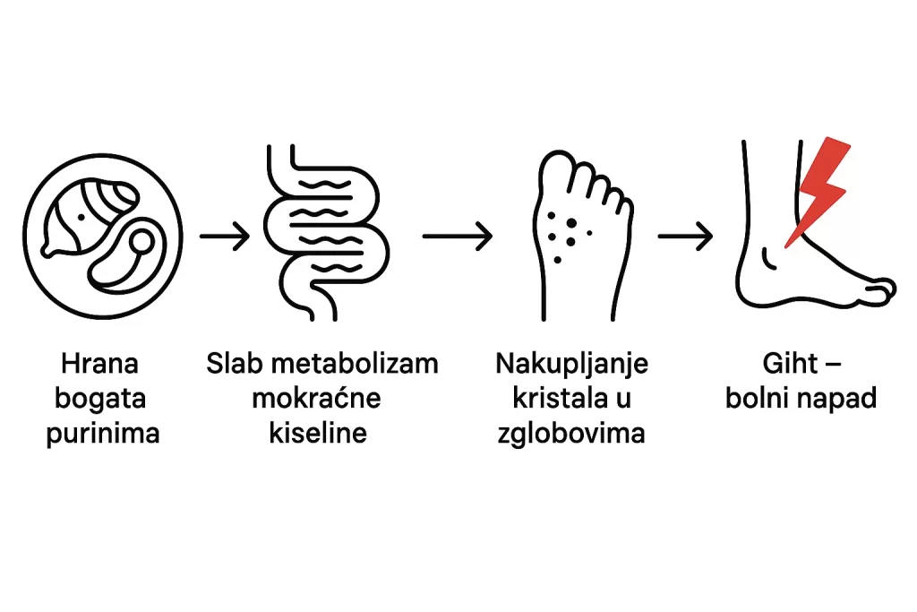 Minimalistička linearna infografika na hrvatskom prikazuje nastanak gihta: hrana bogata purinima → slab metabolizam mokraćne kiseline → nakupljanje kristala u zglobovima → giht – bolni napad.