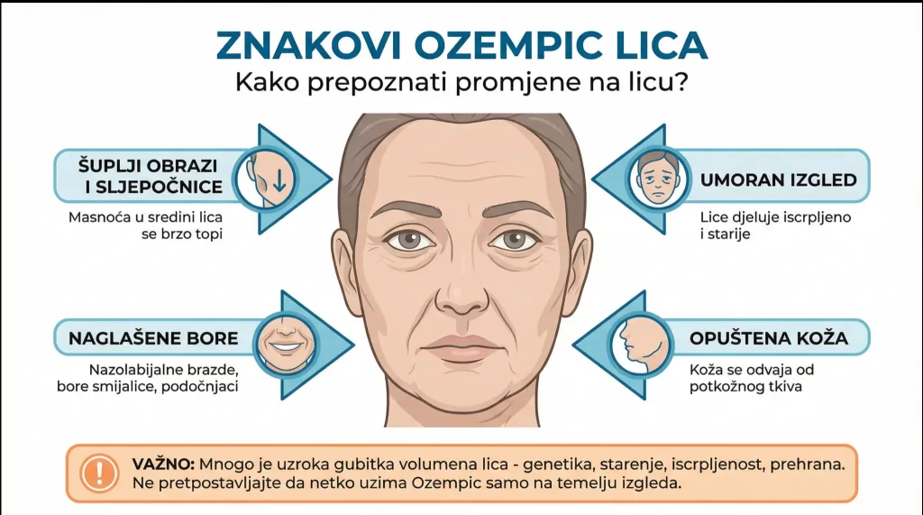 Infografika “Znakovi Ozempic lica” prikazuje glavne promjene na licu pri brzom gubitku težine: šuplji obrazi i sljepoočnice, naglašene bore, umoran izgled i opuštena koža, uz napomenu da postoji više mogućih uzroka gubitka volumena lica.