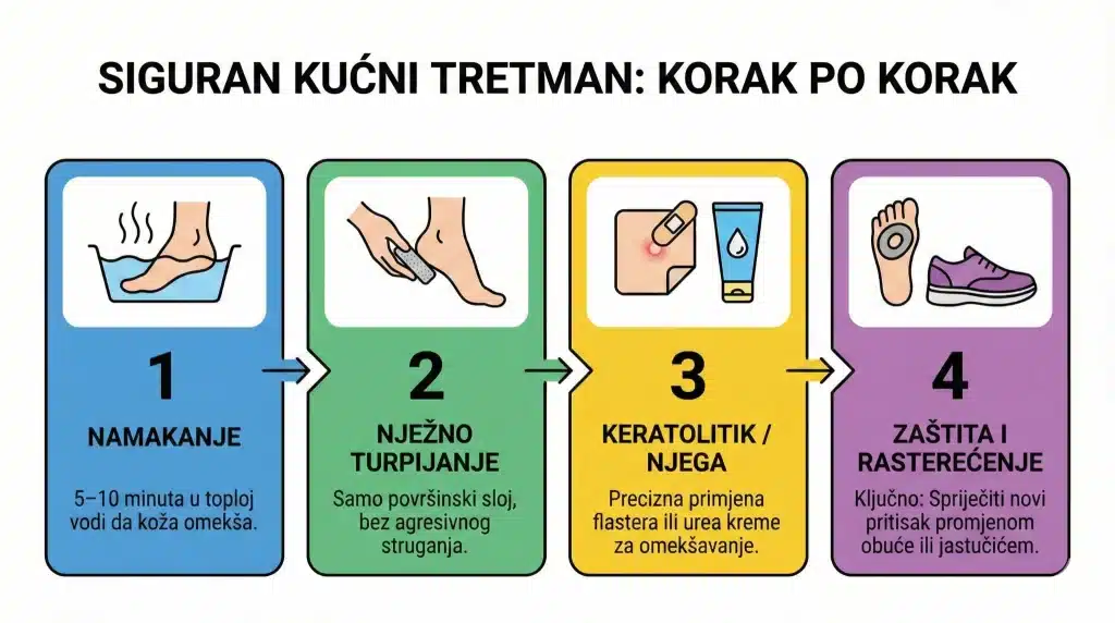 Infografika “Siguran kućni tretman: korak po korak” za kurje oko – 1) namakanje 5–10 min, 2) nježno turpijanje, 3) keratolitik/urea njega, 4) zaštita i rasterećenje promjenom obuće ili jastučićem.
